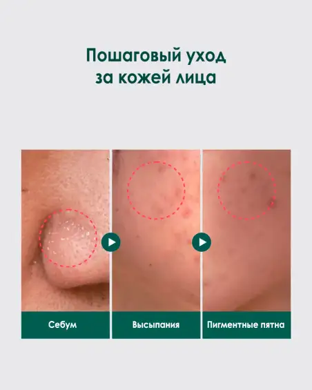 Pine Calming Cica Cream Plus
