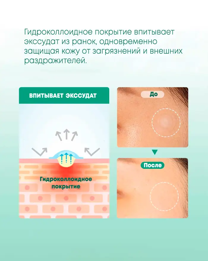 Clear Spot Patch