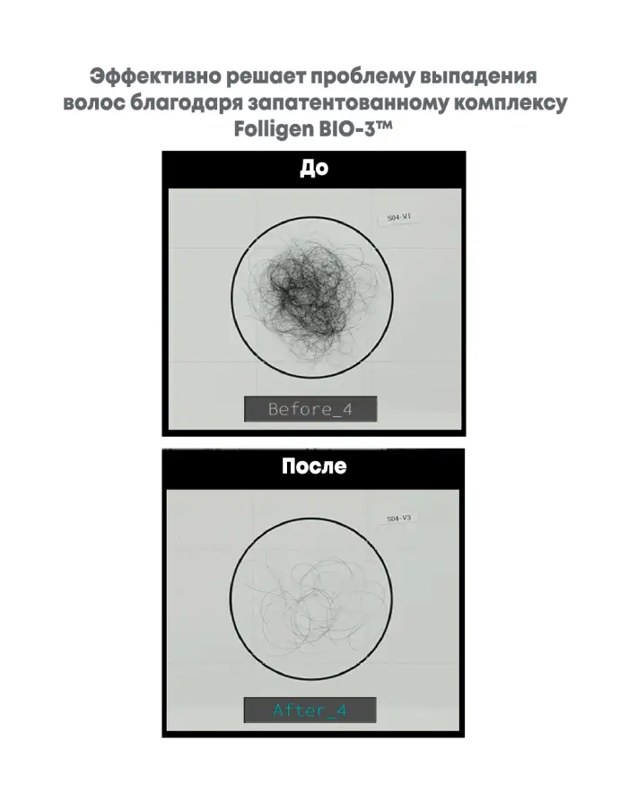 Folligen Bio-3 Shampoo