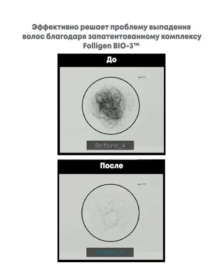 Folligen Bio-3 Shampoo