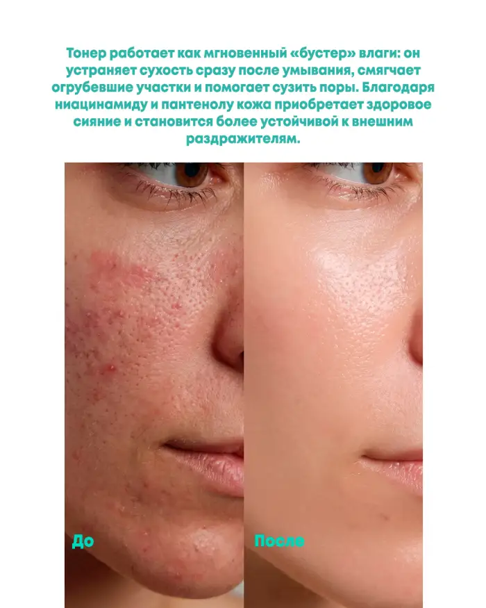 PDRN Toner