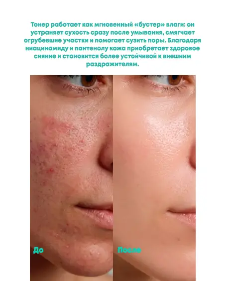 PDRN Toner