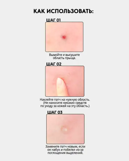 Acne Pimple Master Patch