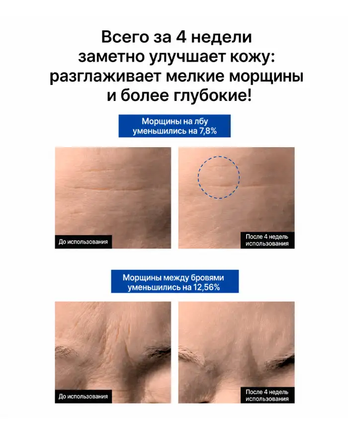 Retinal 300ppm Cream