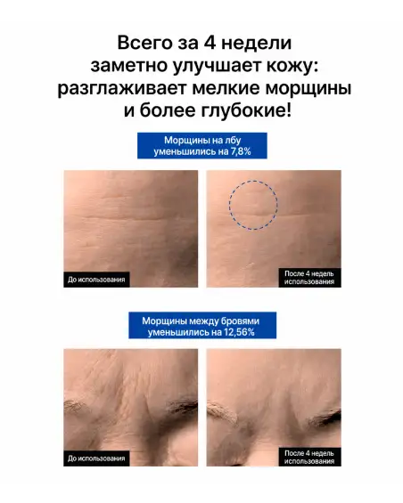 Retinal 300ppm Cream