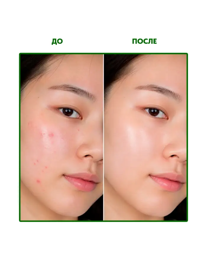 Pine Calming Cica Toner